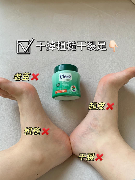 🌳【南非Clere万用小绿膏】1罐=身体乳+干裂膏+手足膜+保湿修复霜+止痒膏+驱蚊膏 商品图5