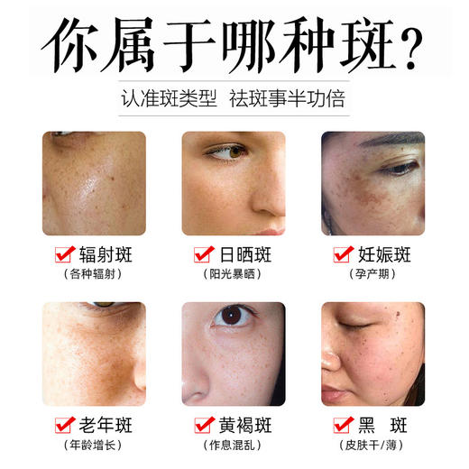 南京同仁堂媄颜美白去角质素祛斑精华霜淡斑色斑去斑面 霜淡斑点霜30g 商品图1