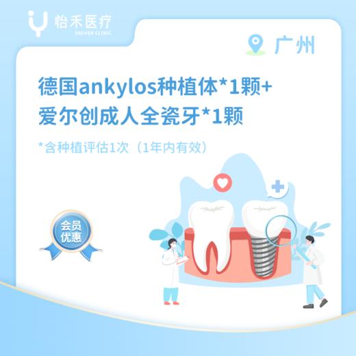 广州【会员】德国 ankylos种植体*1颗+爱尔创成人全瓷牙*1颗 商品图0