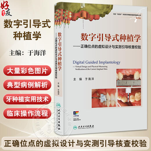 数字引导式种植学——正确位点的虚拟设计与实测引导核查校验 于海洋主编 有助于医生对植入手术进行精准控制等 人民卫生出版社 商品图0