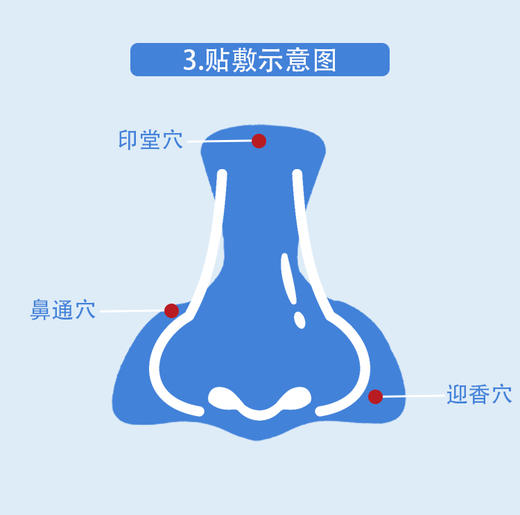 鼻通贴 苍耳子/干姜/桂枝等植物提取 不含激素 5大优势缓解鼻子不适 10贴/盒 商品图4