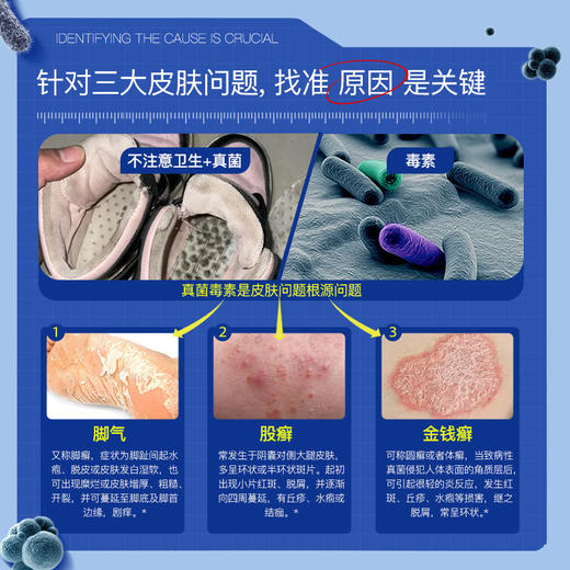 【美国原装进口】Breathy布雷辛布雷希十三肽脚气真菌膏抑菌止痒水泡脚丫脱皮 多重天然植萃精华 快速渗透 温和安全 无依赖性 20g/支 商品图1