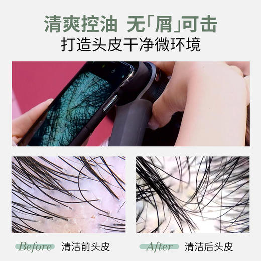 【搭配洗发水】蔚雨堂青蒿头皮素 260ml/瓶 商品图3