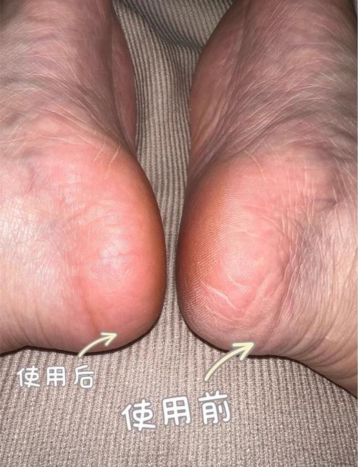 【中欧班列精选】DIICOYAA黛珂娅泰国椰油润肤棒30g/支，倒刺起皮，手脚开裂 商品图7
