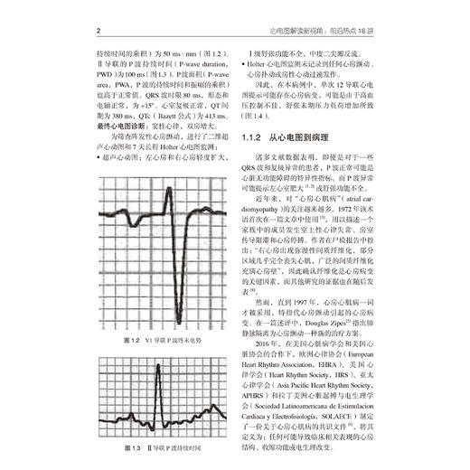 心电图解读新视角 前沿热点18讲 何立芸 张瑞涛 主译 真实病例由浅入深分析基础心电图概念 专题精讲抽丝剥茧解读心电学前沿理念 商品图4