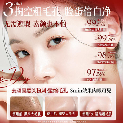 儒意大马士革玫瑰润颜清洁泥膜200g  清洁泥膜去黑头粉刺深层清洁收缩毛孔美白涂抹面膜|儒意官方商城 商品图2