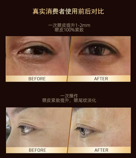 【兰蓓诗】鎏金多肽眼部三件套 眼霜 眼油 眼膜 商品图5