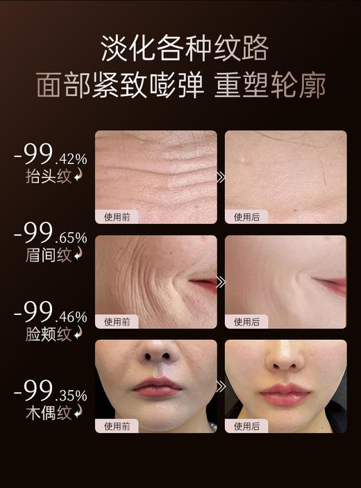 【兰蓓诗】赋颜饱满紧致套装淡化各种纹路重塑轮廓 商品图4