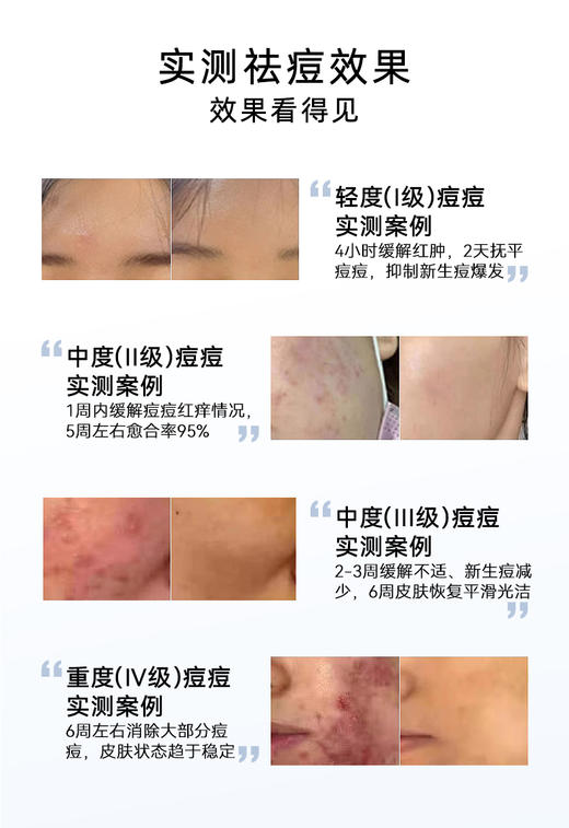 【兰蓓诗】祛痘王组合 祛痘淡化印痕 平衡油脂 细腻毛孔 商品图2