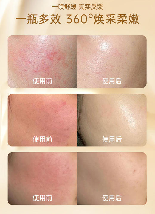 【兰蓓诗】小分子多肽舒缓喷雾  补水舒缓止痒褪红 修复基底层 商品图4