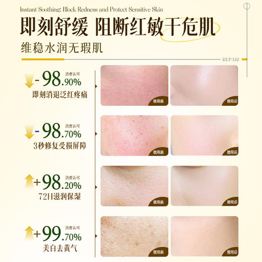 【99任选3件|均价￥33/件】儒意晒后舒缓安肌凝露50g  b5保湿面霜补水滋润晒后敏感修复肌肤舒缓泛红换季屏障受损修护霜|儒意官方旗舰店 商品图1