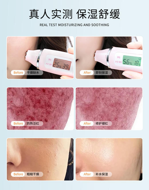 【兰蓓诗】小分子美肌液110ml补水保湿修复屏障舒敏褪红 商品图4