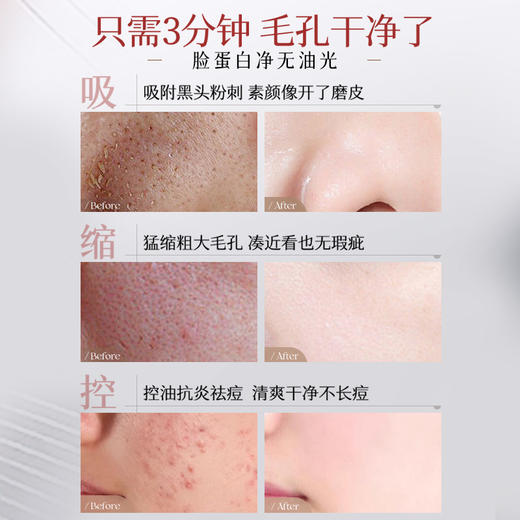 儒意大马士革玫瑰润颜清洁泥膜200g  清洁泥膜去黑头粉刺深层清洁收缩毛孔美白涂抹面膜|儒意官方商城 商品图4