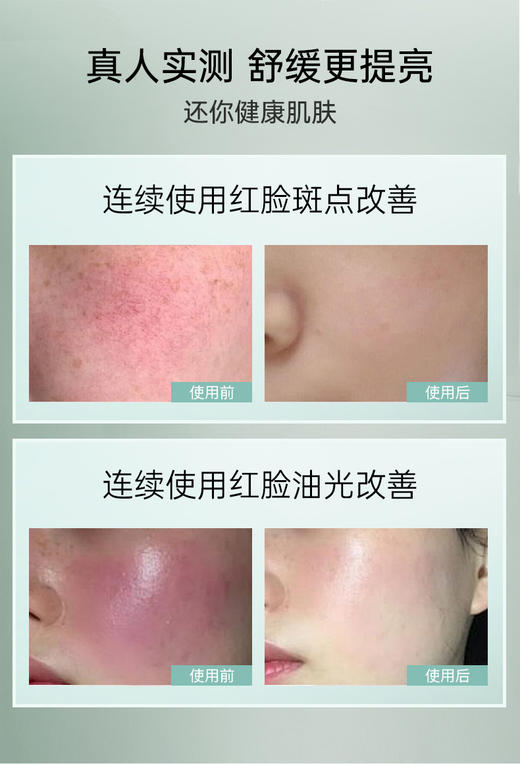 【兰蓓诗】呵护精华液 温和美白 安抚脆弱 呵护红敏肤质 商品图4