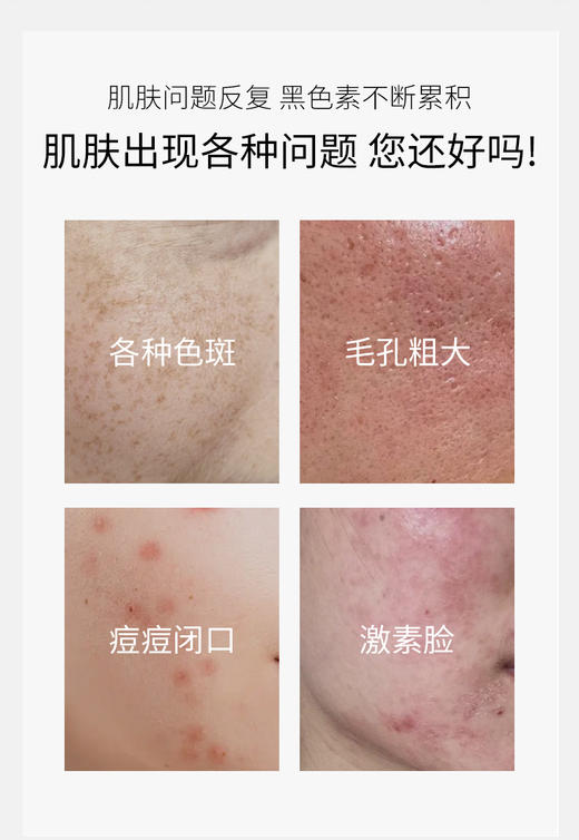 【兰蓓诗】透肌液 祛斑美白修护促进血液循环 商品图1