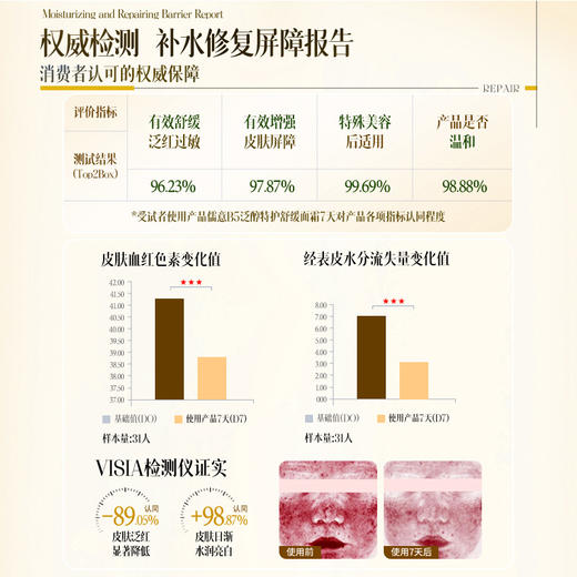 【99任选3件|均价￥33/件】儒意晒后舒缓安肌凝露50g  b5保湿面霜补水滋润晒后敏感修复肌肤舒缓泛红换季屏障受损修护霜|儒意官方旗舰店 商品图3