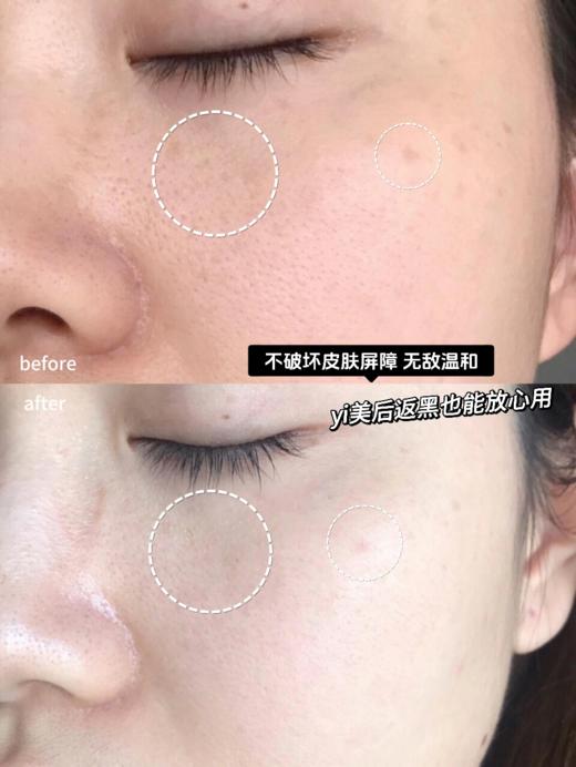 【清仓好价】艺霏虾青素精华30ml 商品图2