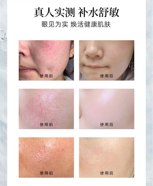 【兰蓓诗】呵护精华面膜 蚕丝膜布深层补水多重修护 商品图4