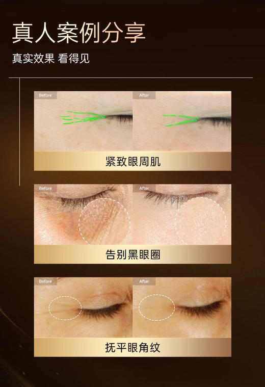 【兰蓓诗】鎏金多肽抗皱眼膜 收紧眼袋 紧致舒纹 商品图4