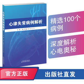 心律失常病例解析