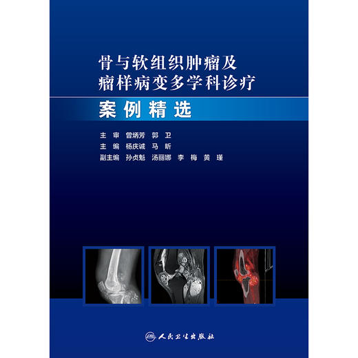 骨与软组织肿瘤及瘤样病变多学科诊疗案例精选 商品图1