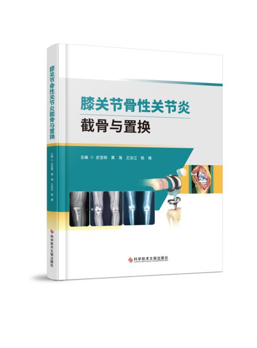 膝关节骨性关节炎截骨与置换 史宝明 黄海主编 商品图0