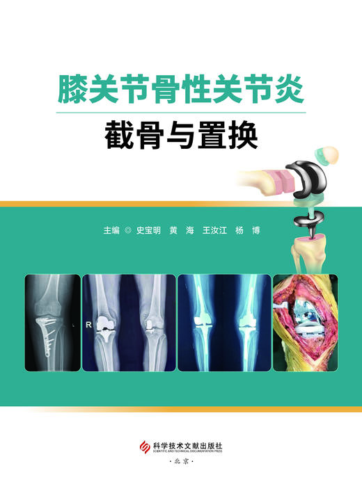 膝关节骨性关节炎截骨与置换 史宝明 黄海主编 商品图1