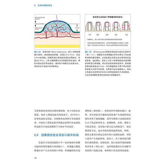 口腔种植骨增量手术精要（德）亨德里克·特海登 生物学原则外科手术技巧临床挑战 9787559140203辽宁科学技术出版社 商品图4