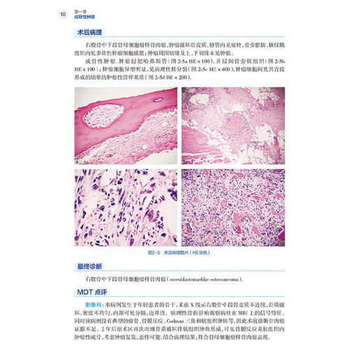 骨与软组织肿瘤及瘤样病变多学科诊疗案例精选 杨庆诚 马昕编 肿瘤学外科学 适合骨肿瘤外科 影像科等相关领域医师 人民卫生出版社 商品图4
