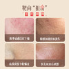 【包税】Ausbelle澳思蓓 优格霜急救水光霜 小样 3g/包*4 商品缩略图2