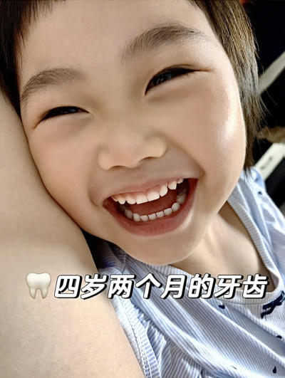 【德国🇩🇪宝儿德儿童乳牙牙刷】2支牙刷💰29.9❗赠送50ml牙膏一支（随机口味1支）❗德国百年高端口腔清洁品牌🏆专为乳牙期儿童设计，旗舰店同规格💰53.15！ 商品图10