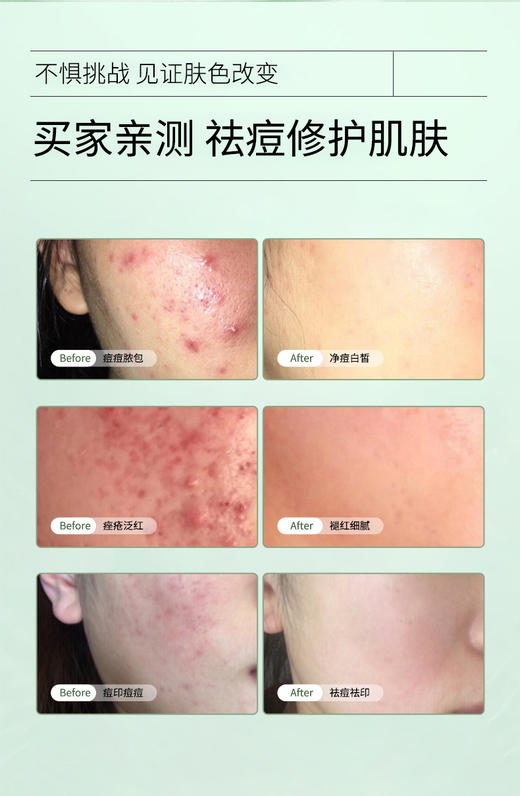 【兰蓓诗】清颜靓肤精华霜 抗炎祛痘 收缩毛孔 舒缓淡印 商品图3