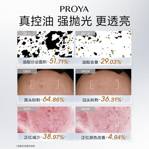 【双旦礼遇季】珀莱雅净源油皮水控油祛痘精粹舒缓湿敷水补水保湿爽肤水改善闭口 商品图1