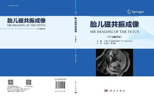 胎儿磁共振成像 商品图3