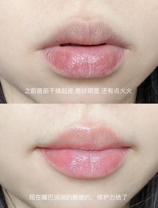 正品带防伪【香港大药房唇炎型医用凝胶】 吊打一切唇膏‼线下①支89元！我们②支29.90元 拯救顽固唇炎、软化死皮、改善干裂、淡化唇纹，还你健康嘟嘟唇 🔺0酒精 0香精 0激素❌不含任何化学添加剂 商品图6