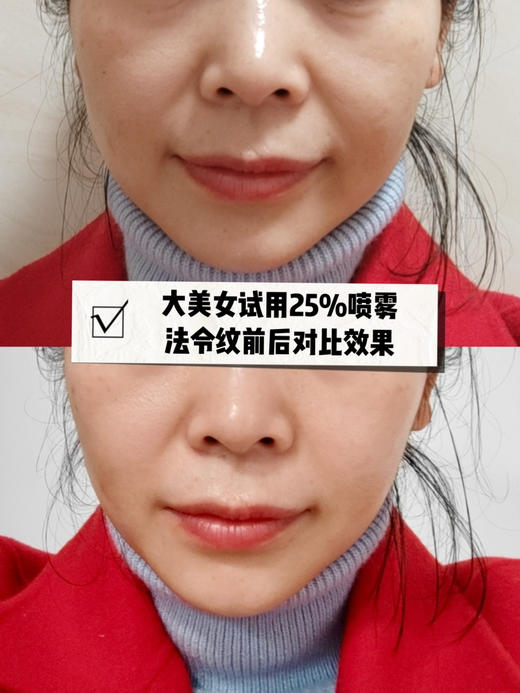 肤思特 年轻态新线雕精华【15%精华液和25%喷雾】瑞士芋螺毒素（精氨酸/赖氨酸）肽添加，即时提升法令纹 隐匿动态纹，紧致面部轮廓和松弛毛孔，对抗松弛下垂 商品图3