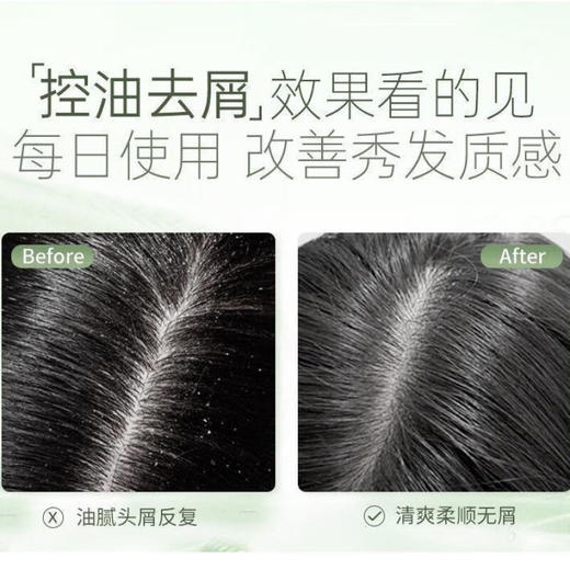 绿色溪谷柔炫丝滑去屑洗发乳促销装480ml+280ml（绿色溪谷柔炫丝滑去屑洗发乳480ml+绿色溪谷凝脂滋养修复发膜280ml） 商品图4