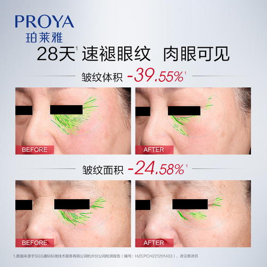 【双旦礼遇季】珀莱雅红宝石眼霜2.0a醇提拉紧致抗皱淡化细纹熬夜眼周 商品图4