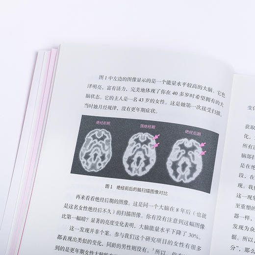 《来吧，更年期！+更年期，怎么办？（套装）》，让我们一起大声讨论更年期 商品图5