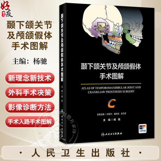 颞下颌关节及颅颌假体手术图解 杨驰 本书适用于口腔颌面外科诸多学科如颞下颌关节外科正颌外科口腔颌面肿瘤外科等人民卫生出版社 商品图0