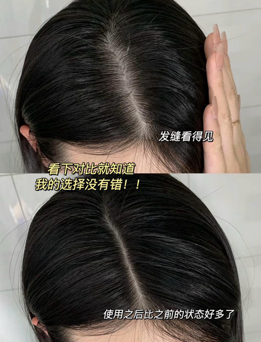 BIOCASTLE防脱润养土耳其科技配方主打8倍防脱促进生发 商品图8