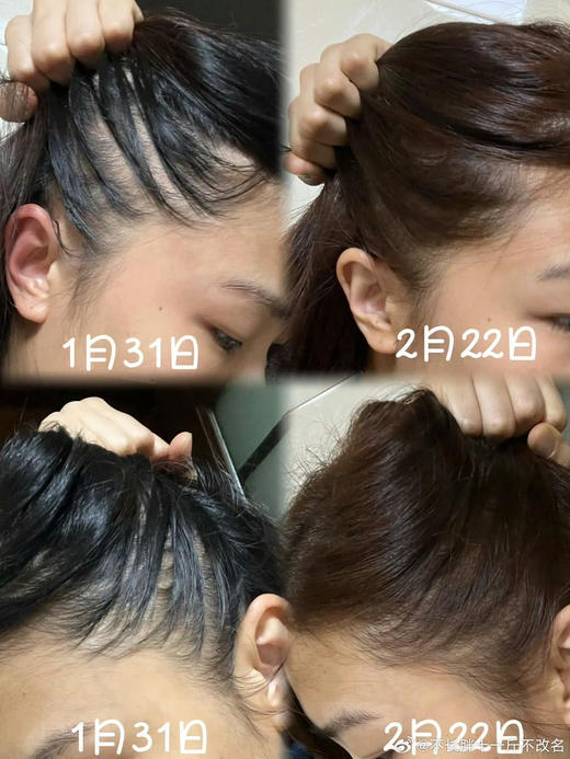 法国康如金鸡纳防脱洗发水固发密法防断发400ml 商品图6