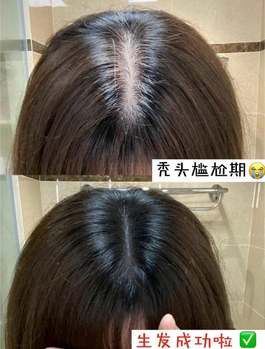 BIOCASTLE防脱润养土耳其科技配方主打8倍防脱促进生发 商品图13