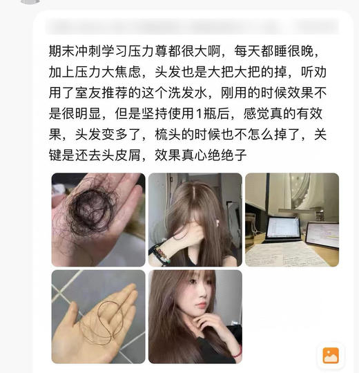 BIOCASTLE防脱润养土耳其科技配方主打8倍防脱促进生发 商品图7