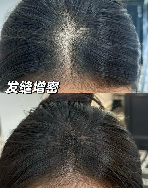 BIOCASTLE防脱润养土耳其科技配方主打8倍防脱促进生发 商品图0