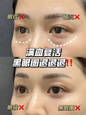 正品水韵梦五重维C肽能淡纹眼膜法令纹漏沟精华膜