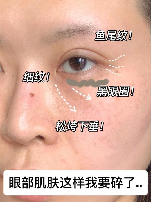 正品水韵梦五重维C肽能淡纹眼膜法令纹漏沟精华膜 商品图13