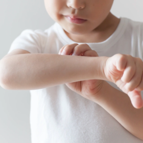当心！宝宝蜕皮暗藏大学问