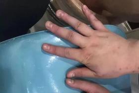  指甲月牙少、有白点、竖纹，是不是身体出问题了？5个小变化千万别忽视 