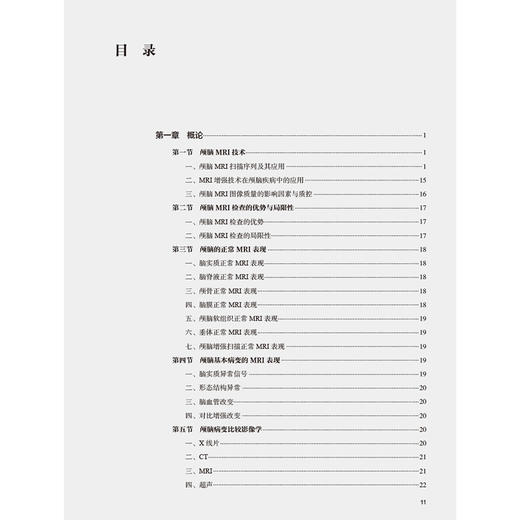 脑部分册 临床磁共振成像系列丛书 程敬亮 文宝红 张勇 主编 涵盖了脑部绝大部分常见和少见疾病相关临床知识和磁共振征象等 商品图3